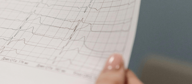 Close-up of ECG graph symbolizing India's evolving healthcare diagnostics ecosystem